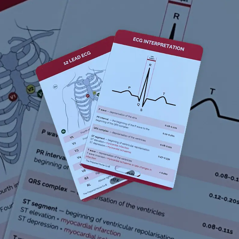 Nursing Reference Card - ECG Interpretation